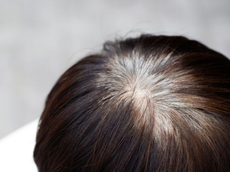 Cudowne naturalne LEKARSTWO na siwienie włosów! Problem milionów osób może zostać łatwo zatrzymany!
