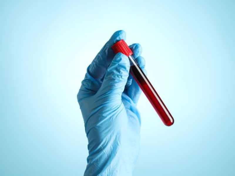 Przełomowe testy krwi wprowadzane w Wielkiej Brytanii! NHS liczy, że uda się dzięki temu uratować tysiące osób!