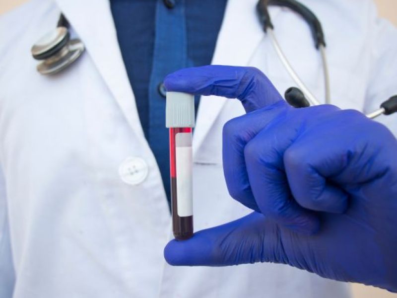 NHS informuje o nietypowej alergii krzyżowej! Twój organizm może reagować na jedzenie, które do tej pory nie sprawiało problemów!