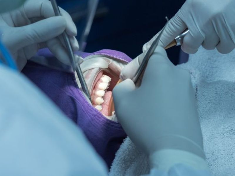 Nowe systemy leczenia dentystycznego na NHS – oto, co ma się zmienić dla pacjentów z problemami z zębami