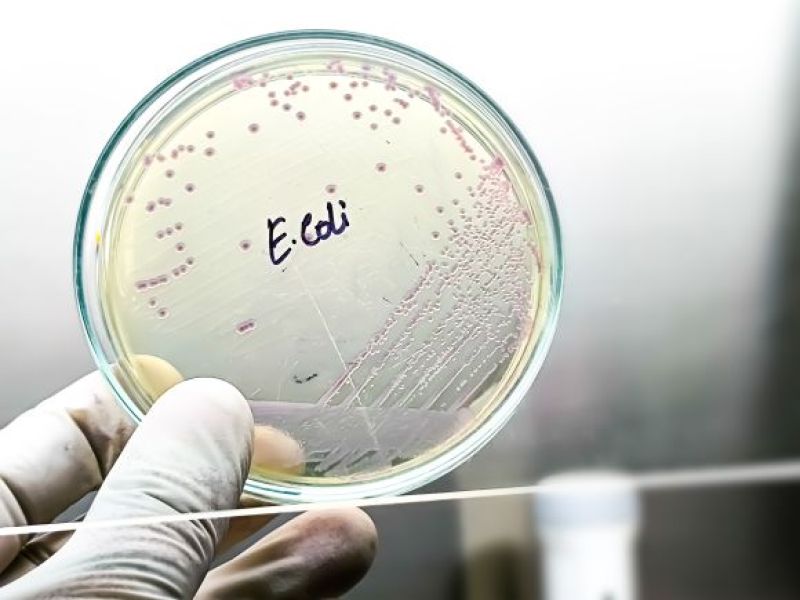 UWAGA! Fala zarażeń groźną odmianą E.coli w Wielkiej Brytanii!