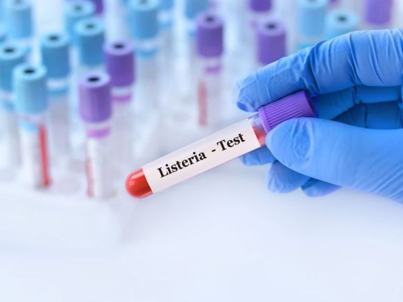 Listeria w produktach sprzedawanych w UK! NIE JEDZCIE TEGO!